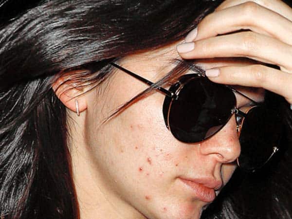 Kendall Jenner Real Natural Face