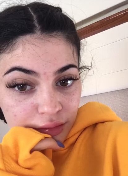 Kylie Jenner Face Freckles