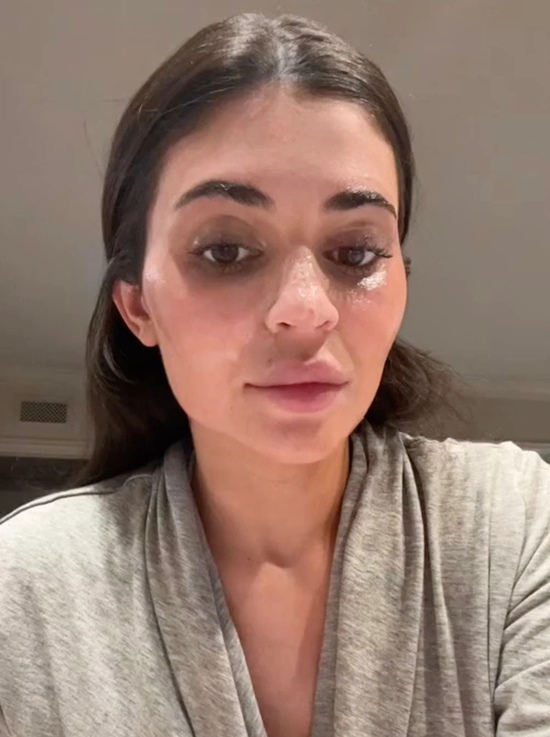 Kylie Jenner Without Makeup Pics