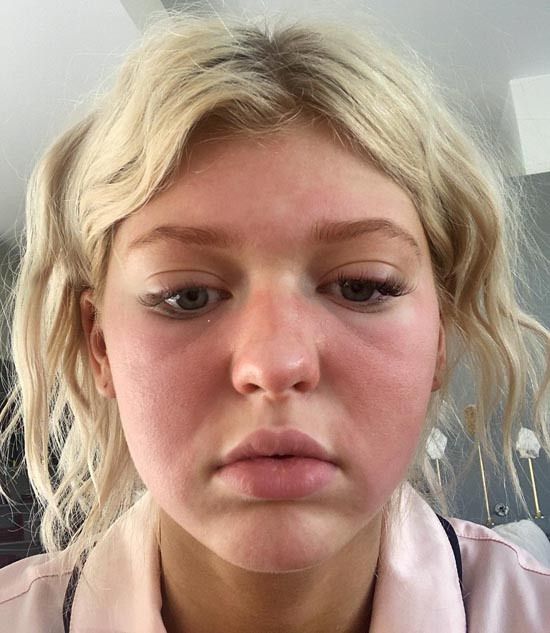 Loren Gray Without Makeup Pictures